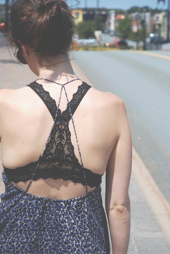 black lace bra, open back dress, floral dress, summer dresses, boho style